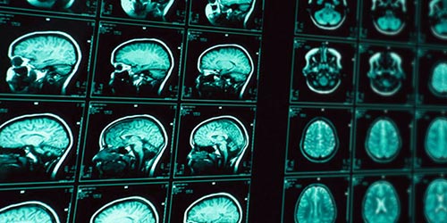 Neuropsicologia
